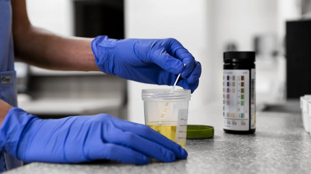 Element AIM® provides comprehensive and detailed urine analysis within minutes